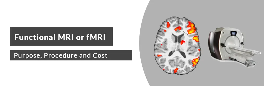  Functional MRI or fMRI: Purpose, Procedure, Cost